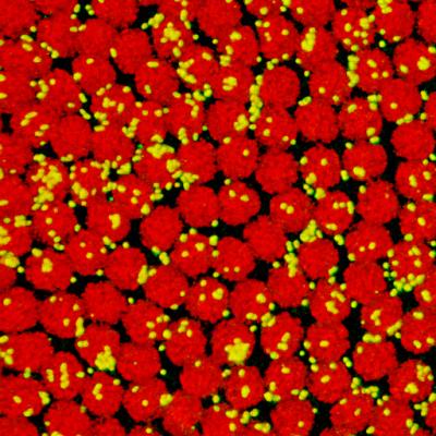 One Species' Genome Discovered Inside Another's (1 of 2)