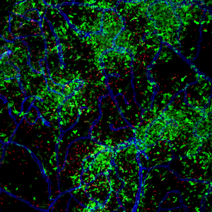 Parasites and macrophages in the meninges