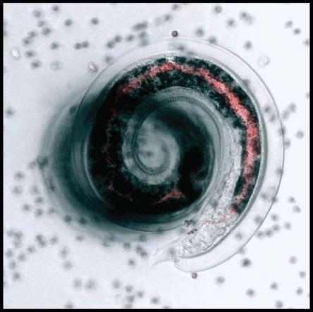 Scientists Identify Potential Drug Target in Blood-Feeding Hookworms