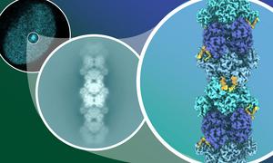 CtBP-RAI2 polymer in a nuclear focus