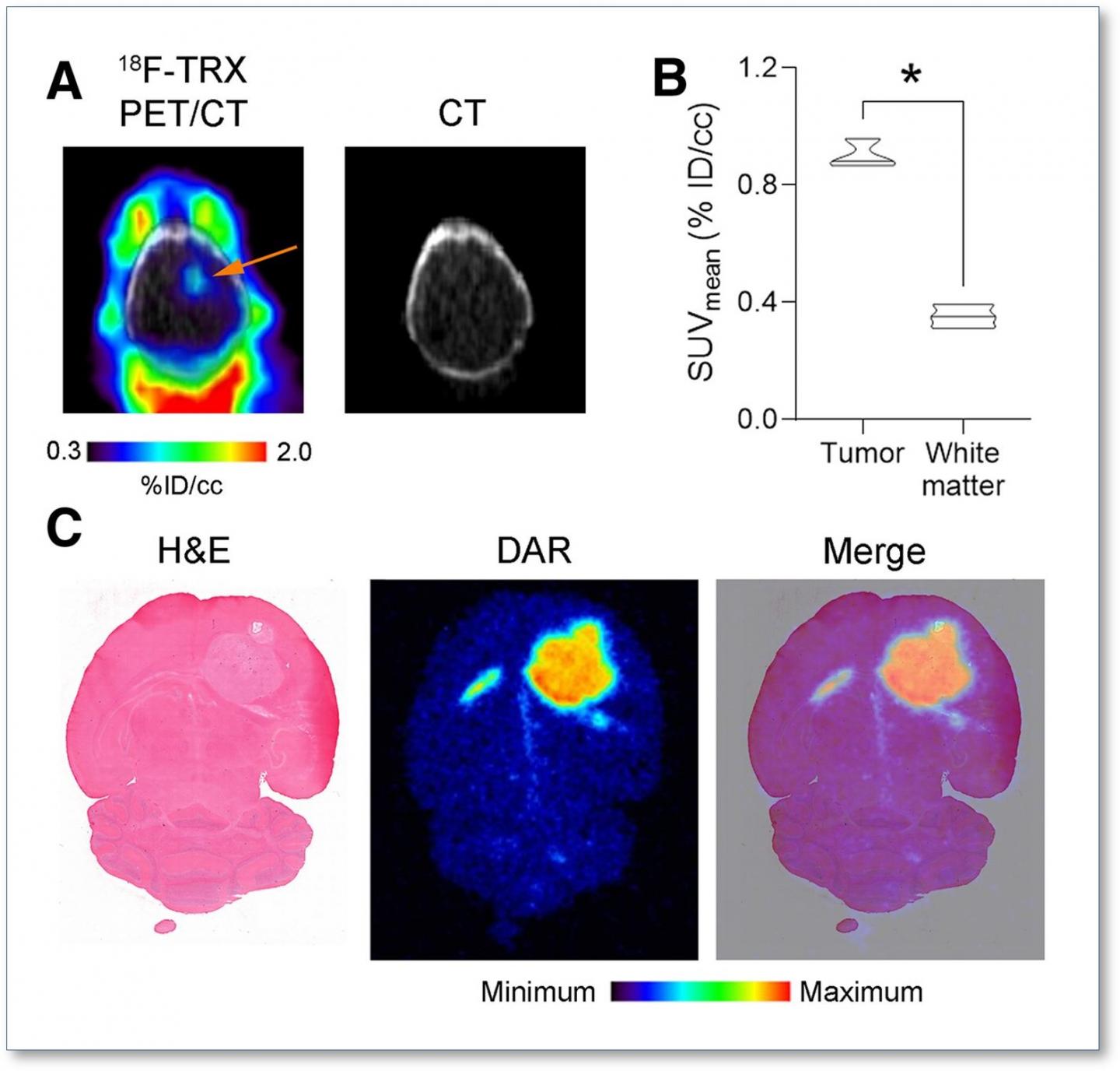 LIP expansion is detectable in an orthotopic glioma model with F-18 TRX.