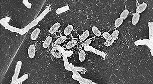 Microbial Communities