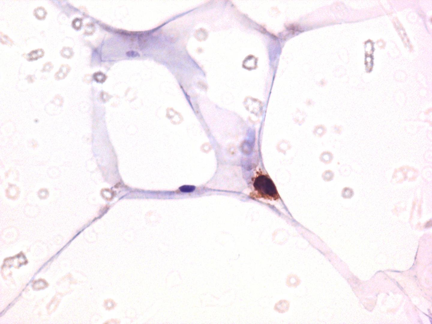 CD4 Staining Among Adipose Tissue