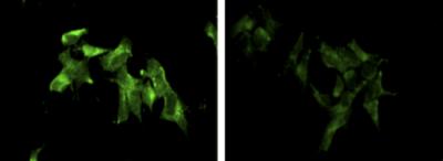 38A Spurs Cells to Manufacture Var IV