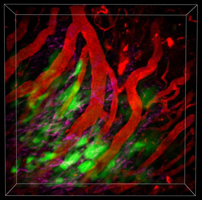 Microscopic view inside mouse model of pancreatic cancer tumour. 2