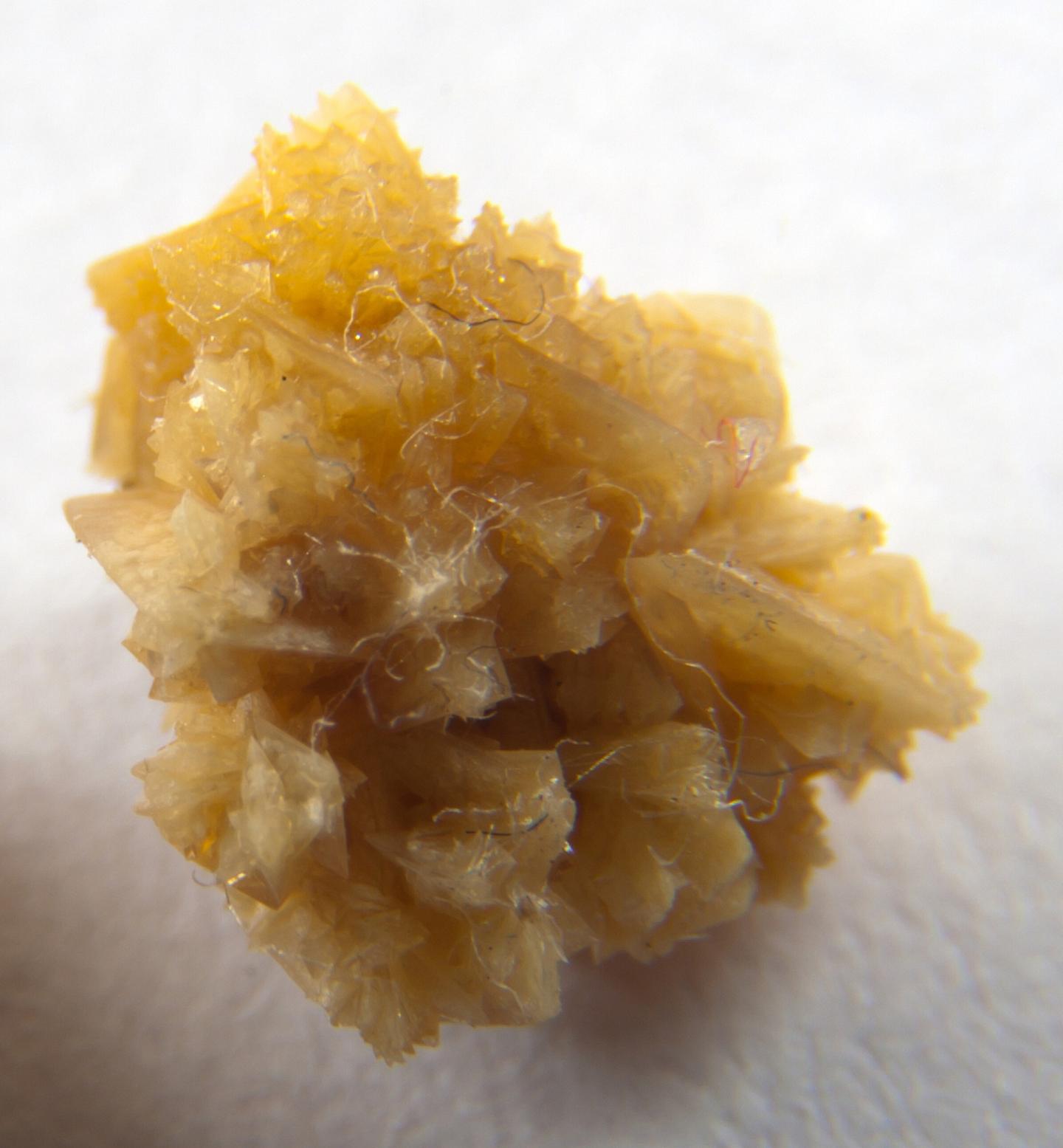 Kidney Stone