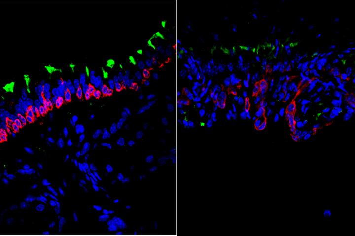 Stem Cells in Young (Left) and Old (Right) Airways