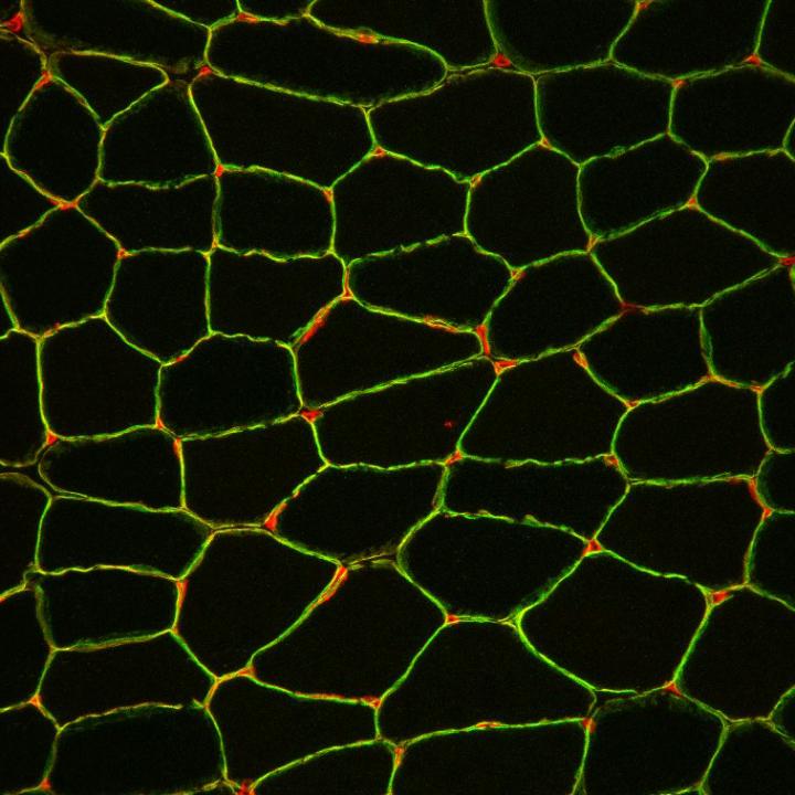Cross Section of a Muscle Biopsy