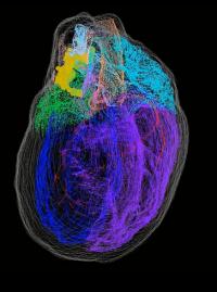 Virtual heart image