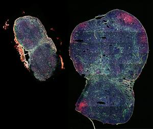 Lymph node expansion upon vaccination