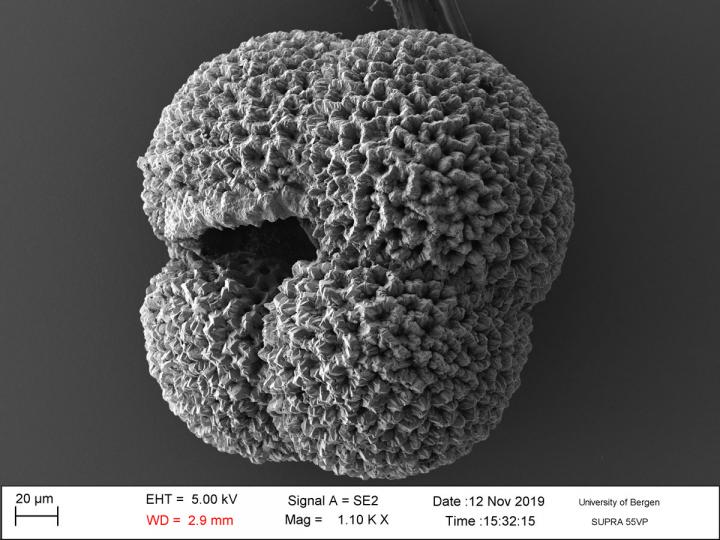 A Microfossil (N. incompta), Taken from the Seafloor Near Greenland