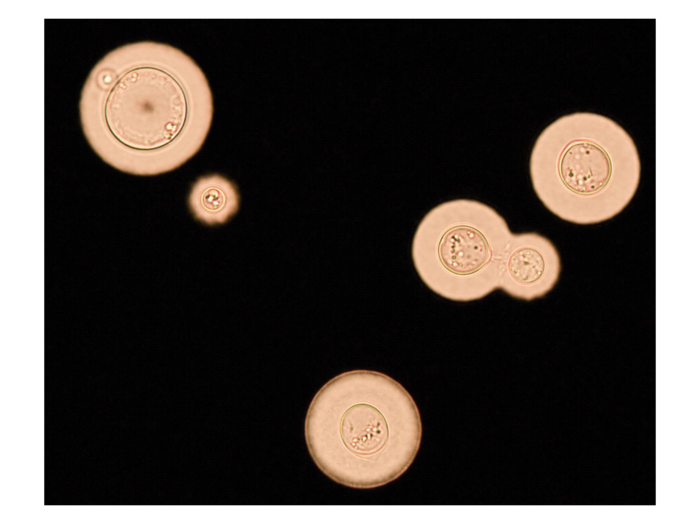 Cryptococcus neoformans