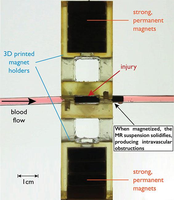 Magnetizable Fluid Could Extend Trauma Patients' Survival Time