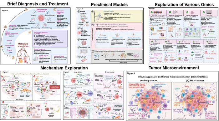 Metastatic Brain Tumors: from development to cutting-edge treatment