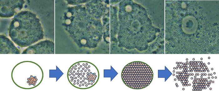 Mimivirus-infected Acanthamoeba cell, visualized under a light microscope