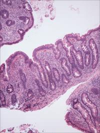 Stained Photomicrographs of Small Intestinal Biopsies
