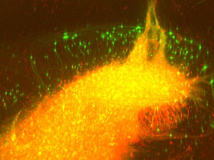 Transplant of Human Neurons in the Hippocampus of a Mouse
