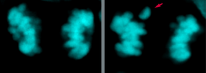 Fewer chromosome segregation errors in modern human than Neanderthal neural stem cells.