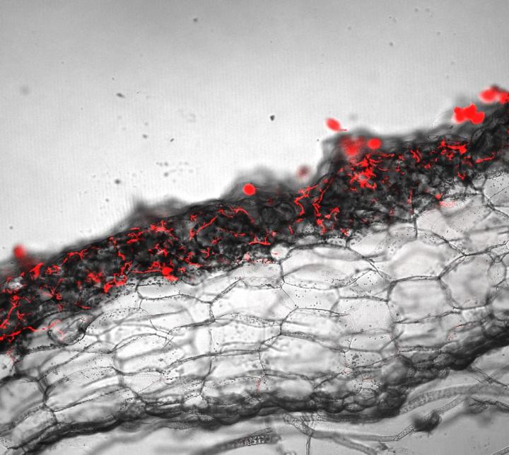 Microbal Infection in Liverwort
