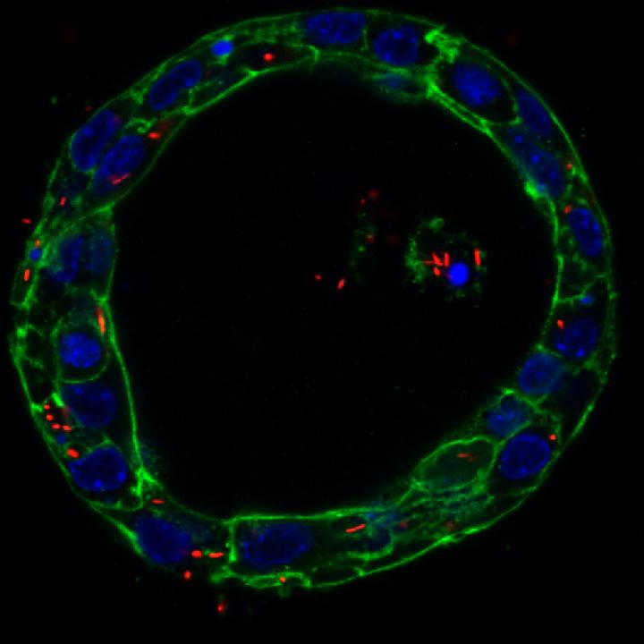 A Slice of a Gallbladder Organoid Infected with Salmonella