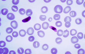 Plasmodium falciparum