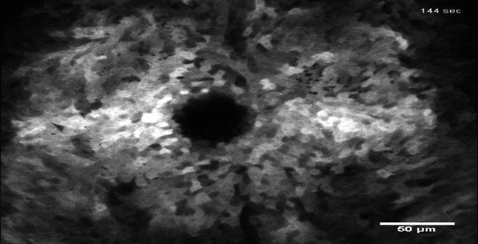 Calcium Signaling Following Cell Injury
