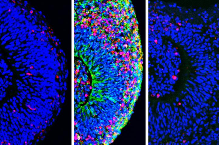 Organoids Before (Left) and after Exposure to Zika (Center), and after Treatment (Right)