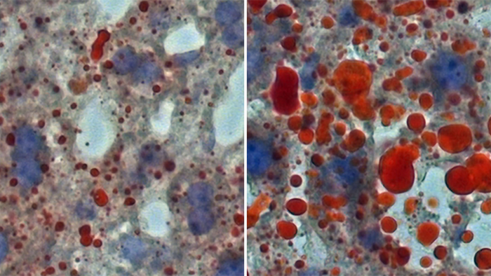 Lipid droplets in mouse liver