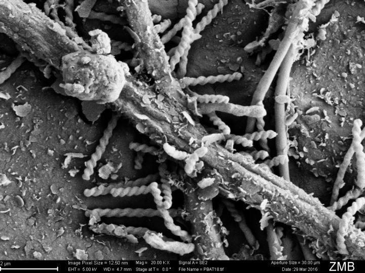 Direct Evidence of Biodegradation of Polymers in Agricultural Soil (2 of 5)