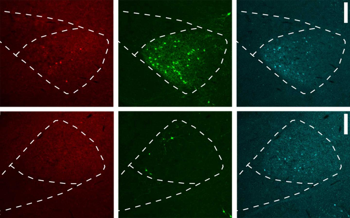 A Better Way to Trace Neurons