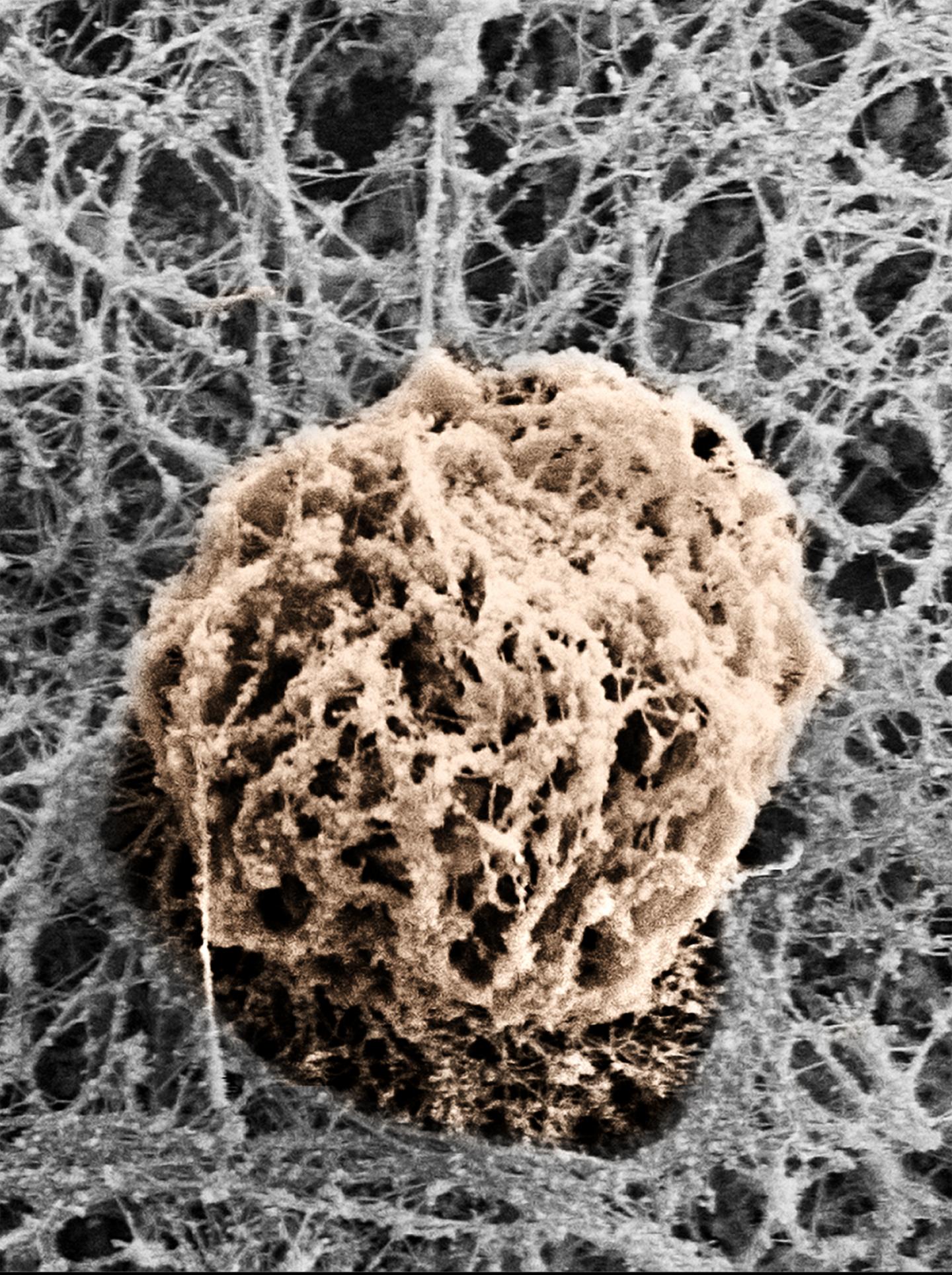 T Cell Squeezes Through Blood Vessel Wall 2