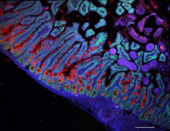 Stained image of Small Intestine Lining