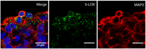 Representative image of the experiment with human brain organoids