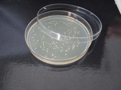 Petri Dish with Bacterial Colonies 
