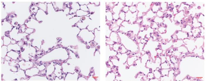 Loss of MAIT cells protects mice from cigarette smoke-induced COPD