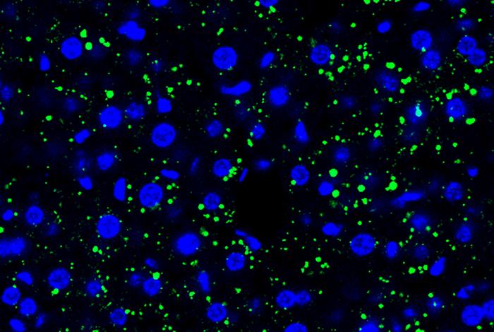 Tumor cell-derived EVPs induced accumulation of lipid droplets in the mouse liver. Green, lipid droplet. Blue, DAPI.