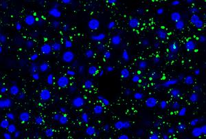 Tumor cell-derived EVPs induced accumulation of lipid droplets in the mouse liver. Green, lipid droplet. Blue, DAPI.