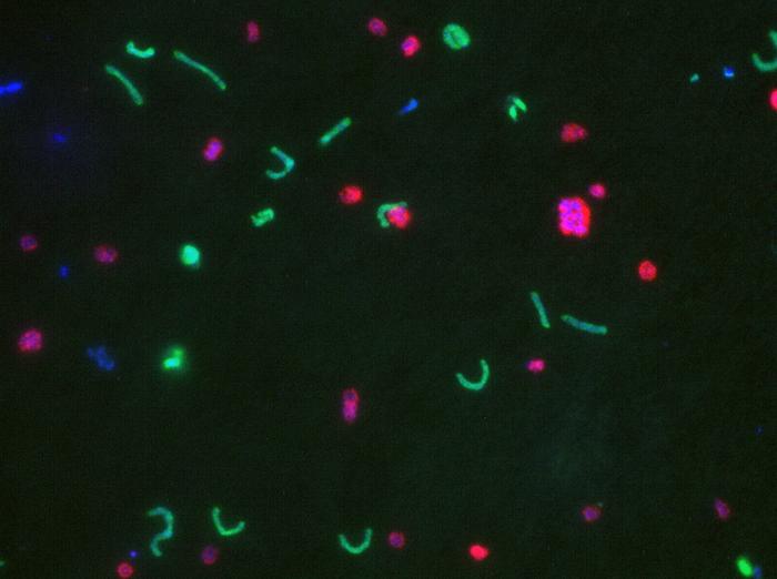 The Who's Who of Bacteria: A Reliable Way to Define Species and Strains