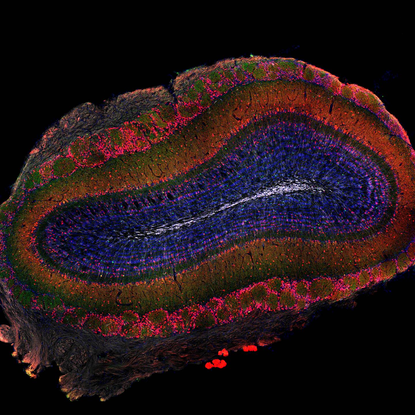 Distant Brain Regions Selectively Recruit Stem Cells