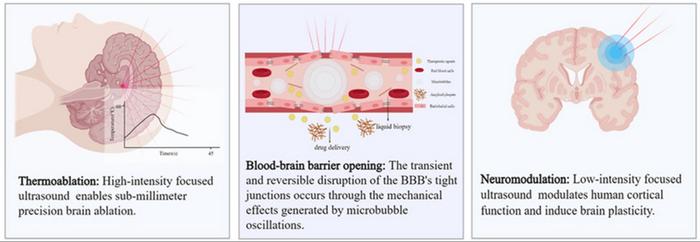 THE MECHANISM OF MAGNETIC RESONANCE-GUIDED FOCUSED ULTRASOUND