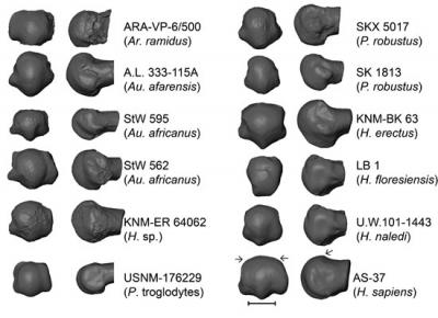 Distal (Left) and Lateral (Right) Views of Fossil Hominin and Modern Human First Metatarsal Heads