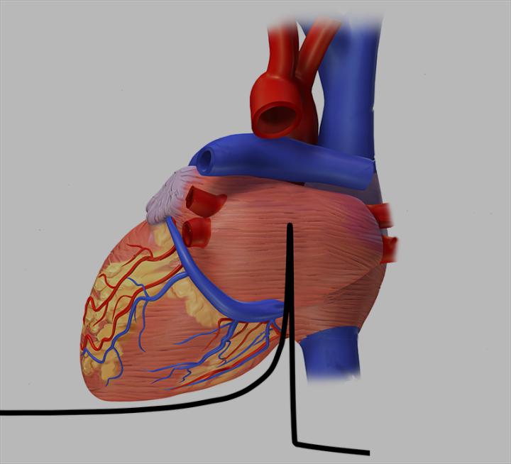 Irradiating the Heart with Ions