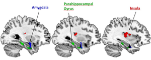 Relevant brain areas