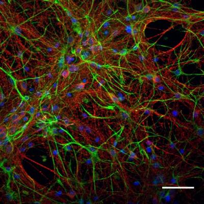 Hybrid Networks of Neurons and Self-Standing Nanotubes (Confocal Micrograph)