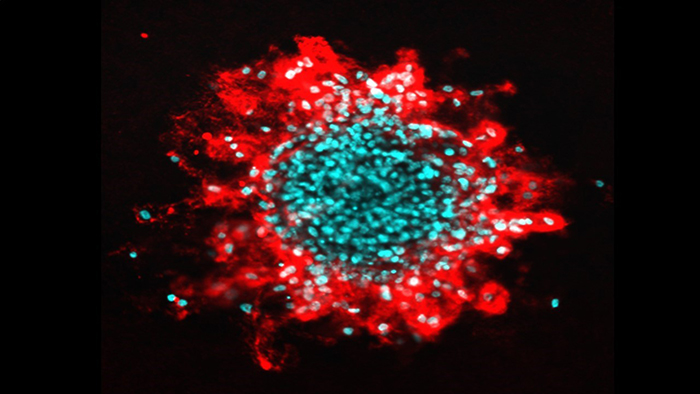 Image of human tumour cells invading a collagen matrix