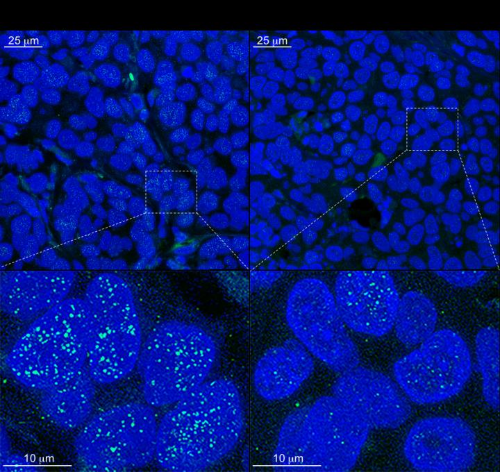 PI3K and TRF1, Connected for the First Time