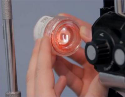 Analysis of Corneal Endothelium