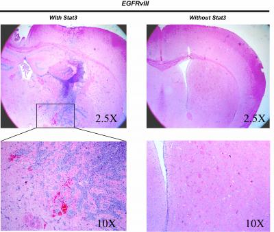 Stat3 as Oncogene