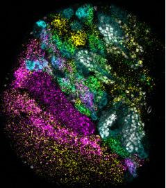 Microscope image of one of the developing fruit fly brain lobes