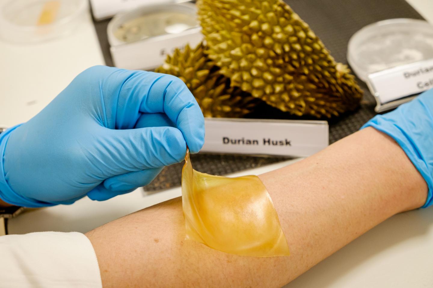 A New Hydrogel Patch Derived from Discarded Durian Husks Can Help Wounds to Heal Better
